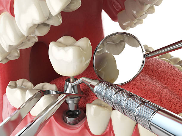 Best After-Hours Emergency Dentist in Marshville, NC