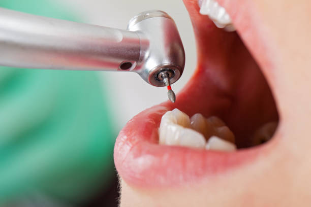 Best Walk-In Emergency Dentist in Marshville, NC